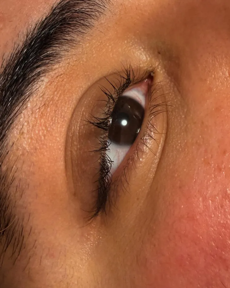 Beauté du regard